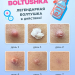 Салициловая суспензия для лица Boltushka от прыщей для локального нанесения, 25 мл